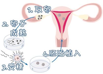 单身生子助孕机构